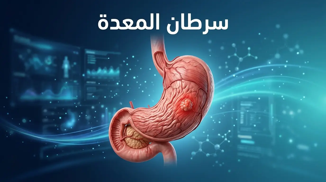 سرطان المعدة: الأعراض المبكرة والأسباب وطرق التشخيص والعلاج